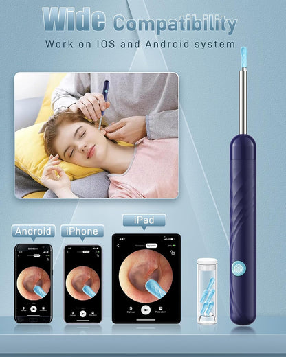 Ear Wax Removal, Ear Cleaner with Camera and Light, FSA - HSA Eligible, Ear Wax Removal Tool Camera with 1080P, Ear Cleaning Kit with 6 Spoons